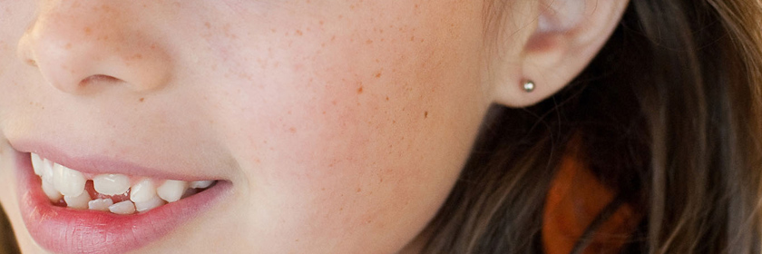 Photograph of a child with their ear pierced